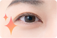 二重術（埋没法）