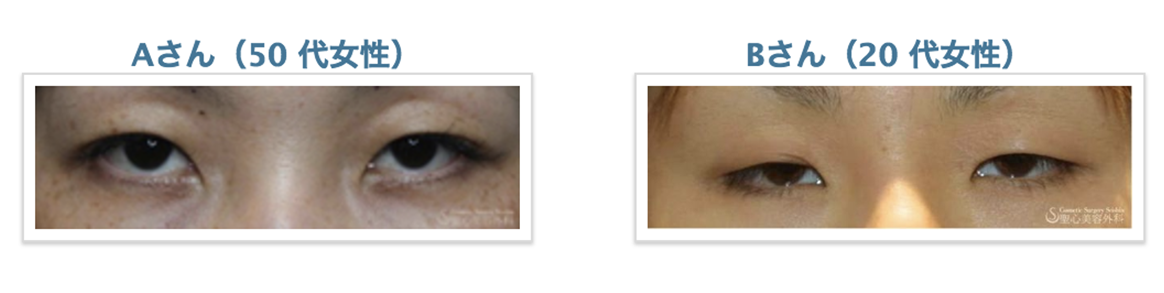 Aさん（50代女性） Bさん（20代女性）