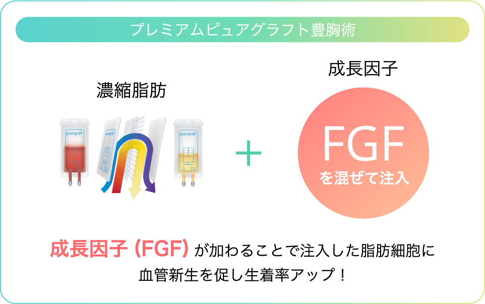 成長因子（FGF）が加わることで注入した脂肪細胞に血管新生を促し生着率アップ