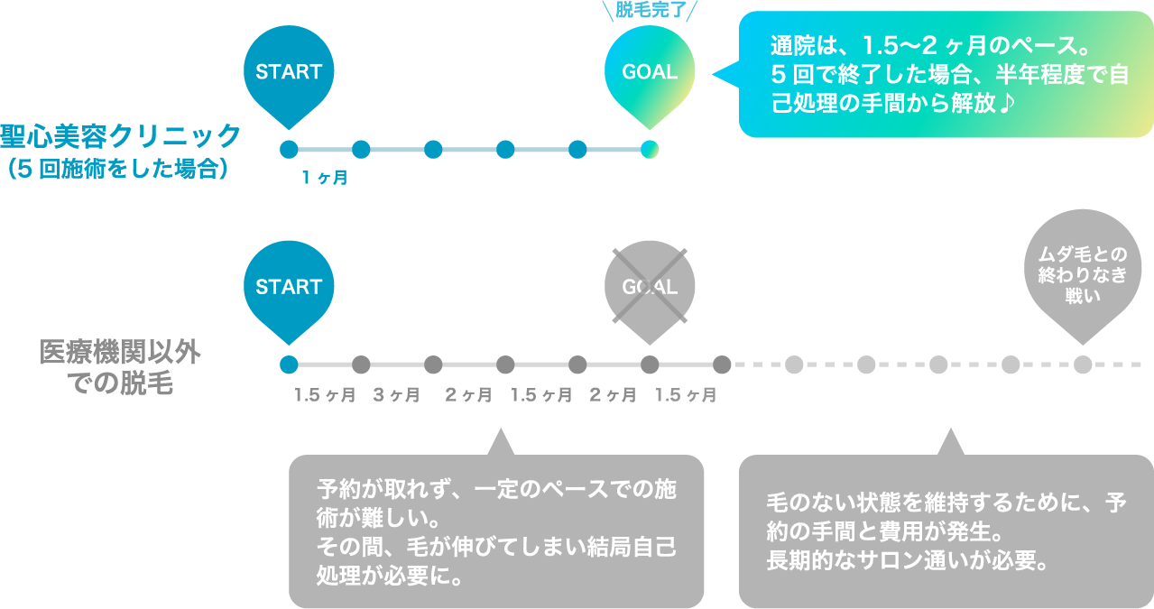 通院は、1.5～2ヶ月のペース。5回で終了した場合、半年程度で自己処理の手間から開放