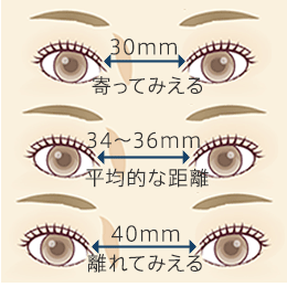 目頭切開｜寄り目にならないか不安ですか？