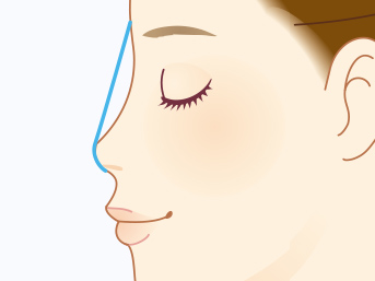 G-Mesh（Gメッシュ）