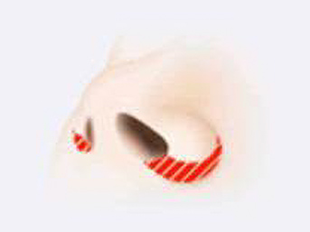 小鼻縮小