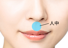 人中短縮ボトックス注入