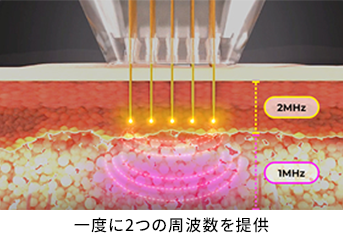 一度に2つの周波数を提供