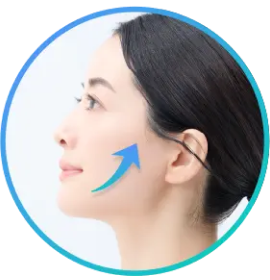 糸リフト（スレッドリフト）とは