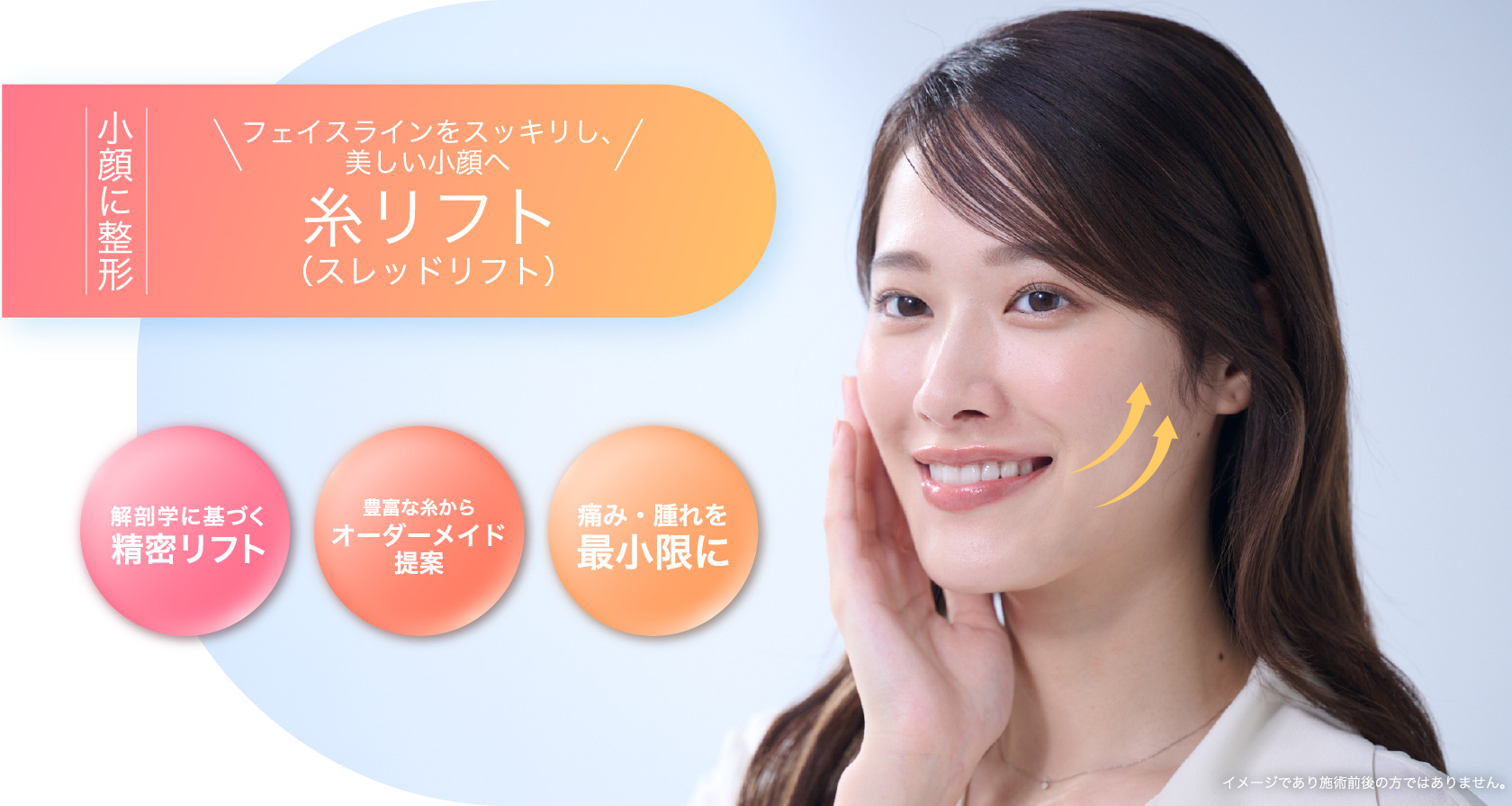 糸リフト（スレッドリフト）