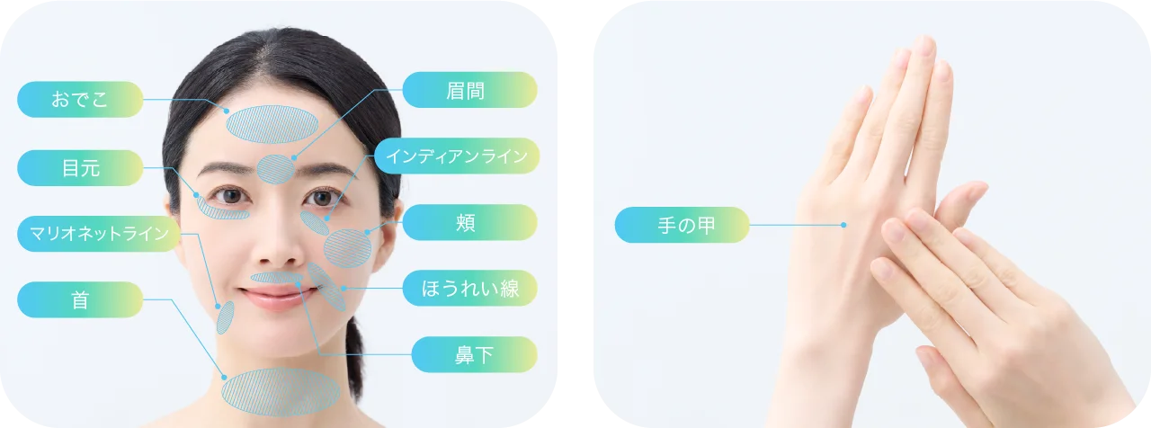 肌の悩み